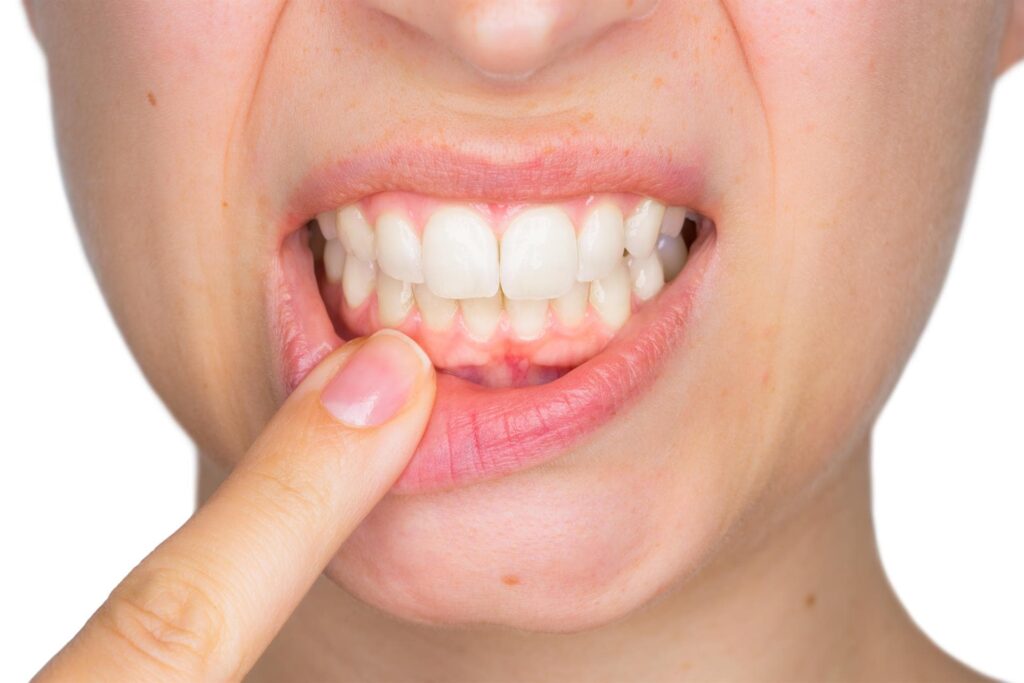 Periodoncia