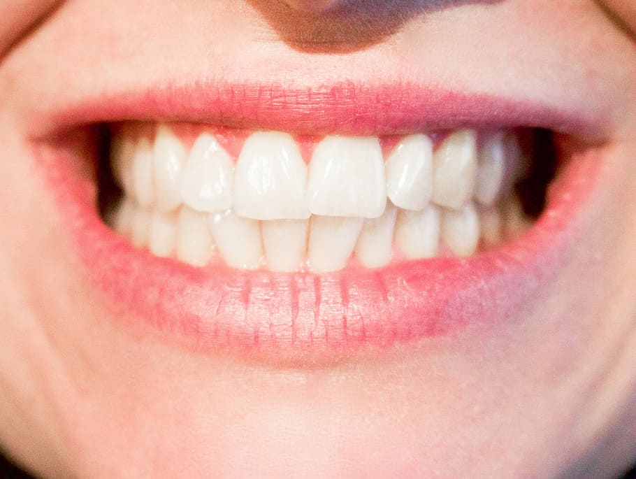 Rehabilitación oral