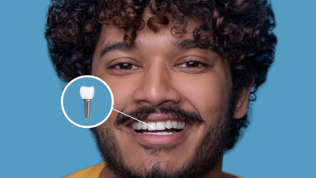 Implante dental